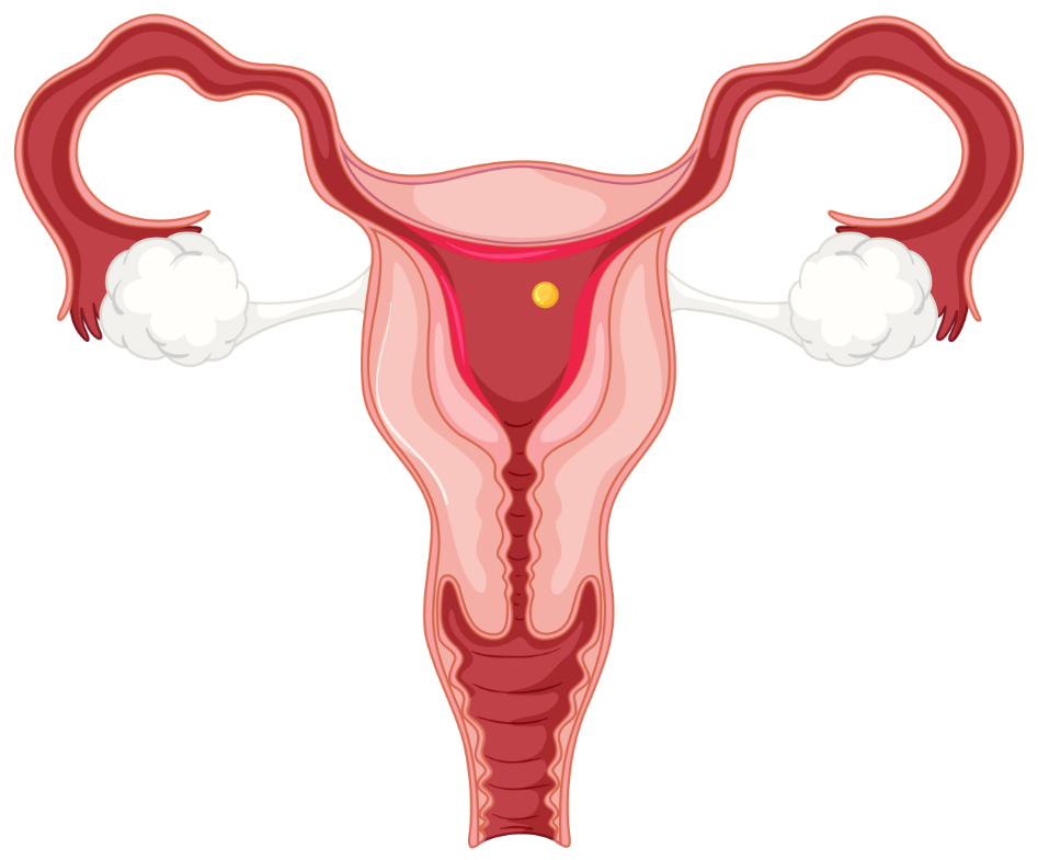 Hizmetler - Intrauterine Biopsy