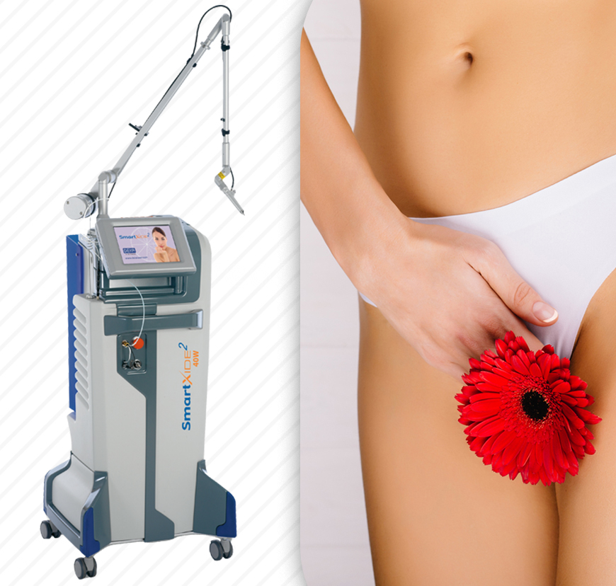 Genital Area  Laser Applications